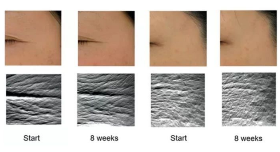 艾詩特蝦青素 艾詩特蝦青素