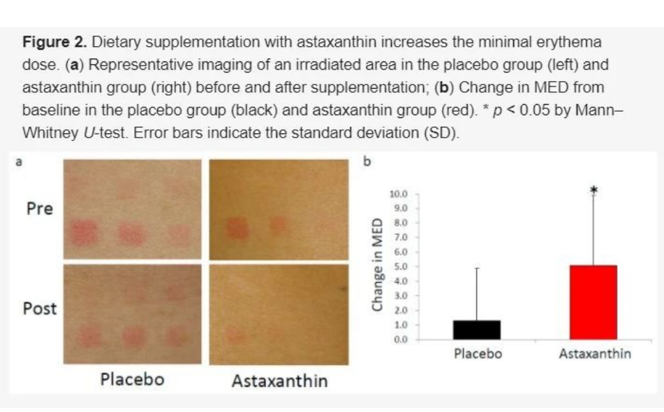 艾詩特蝦青素 艾詩特蝦青素