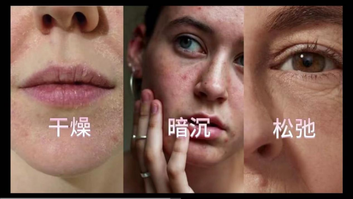 艾詩(shī)特蝦青素