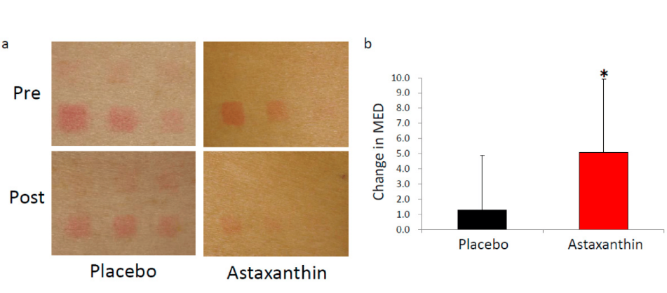 艾詩(shī)特蝦青素
