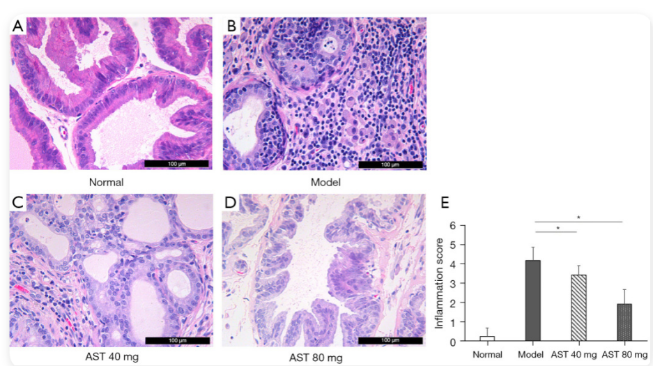 艾詩(shī)特蝦青素
