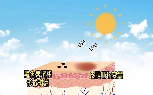 天然蝦青素可以祛斑嗎？